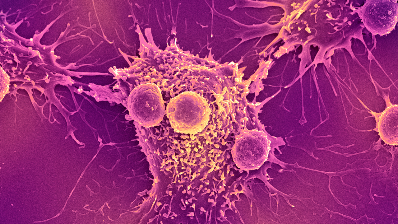 ‘Universal’ cancer vaccine heading to human trials could be useful for ‘all forms of cancer’