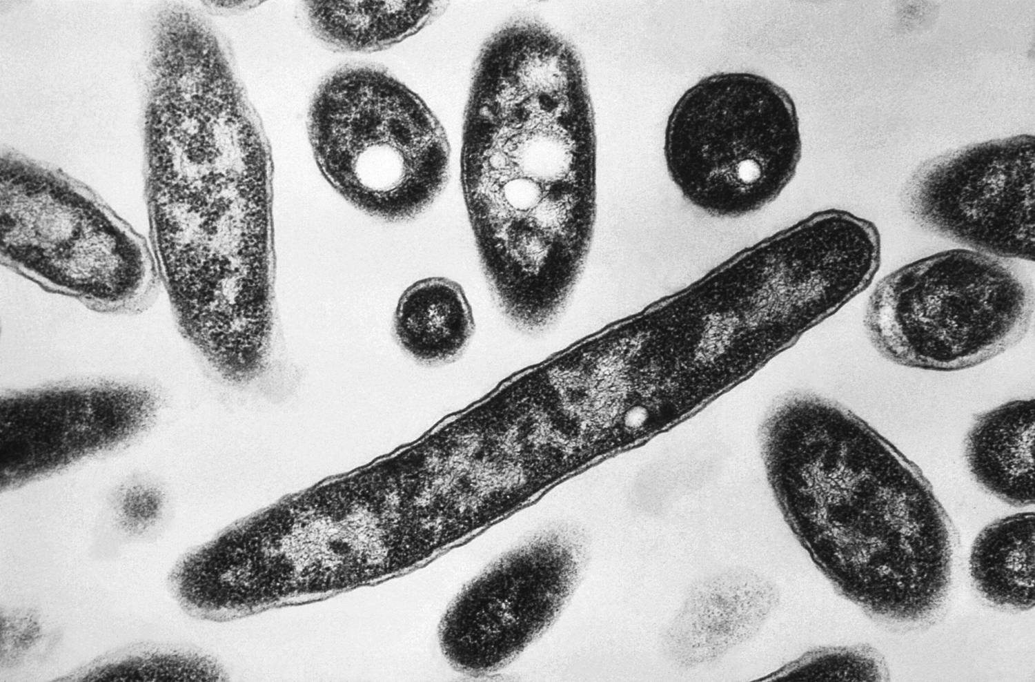 1 dead, 22 sick from Legionnaires’ cluster in Harlem, health officials say