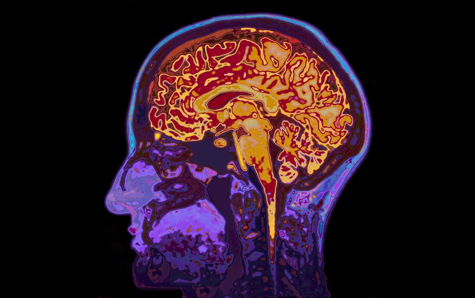 Perceived sickness activates real immune responses