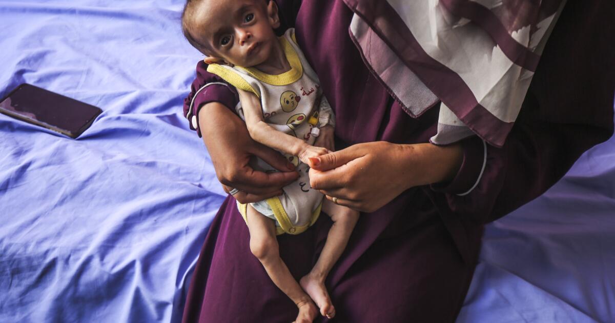 Commentary: Dying babies. Starving adults. Even Rep. Marjorie Taylor Greene is calling it a “genocide”
