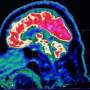 What are all these microplastics doing to our brains?