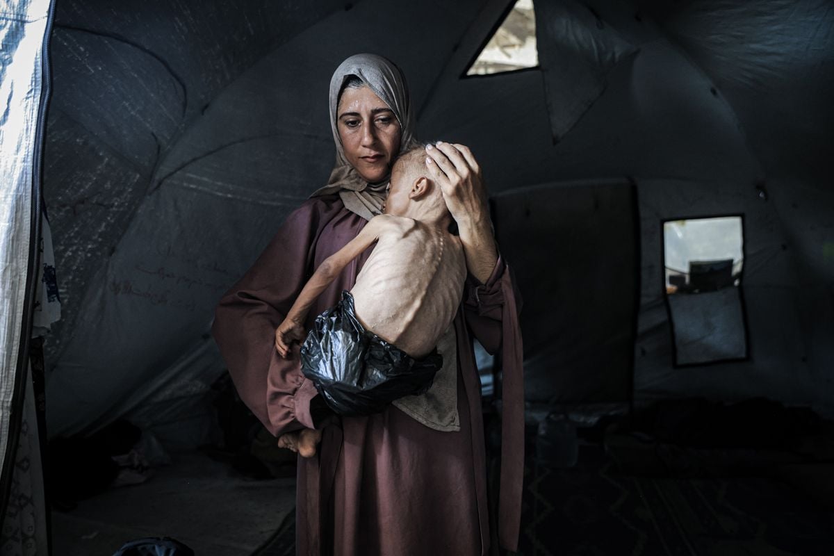 Posts claim image of emaciated boy doesn’t represent mass starvation in Gaza. Here’s context