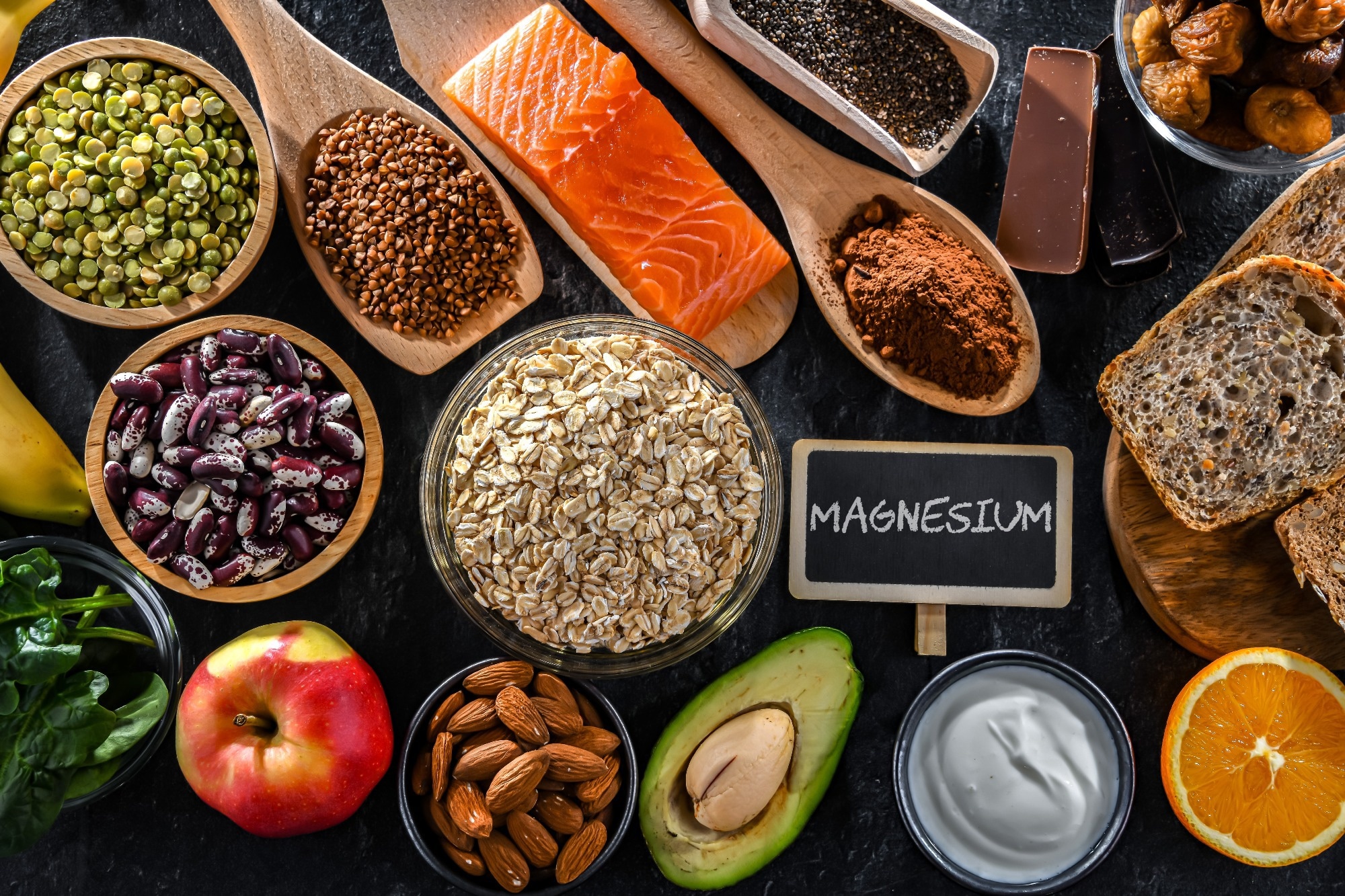 Magnesium deficiency drives higher mortality in hyperlipidemia