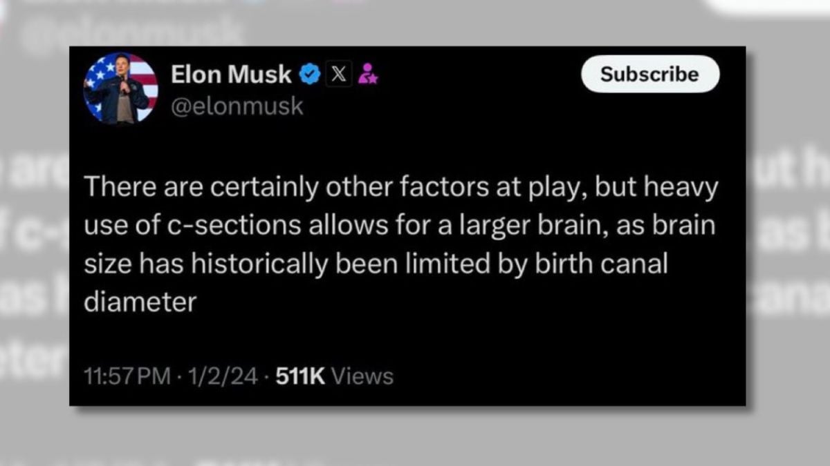 Musk Claimed C-Sections Allow Babies to Have Larger Brains?