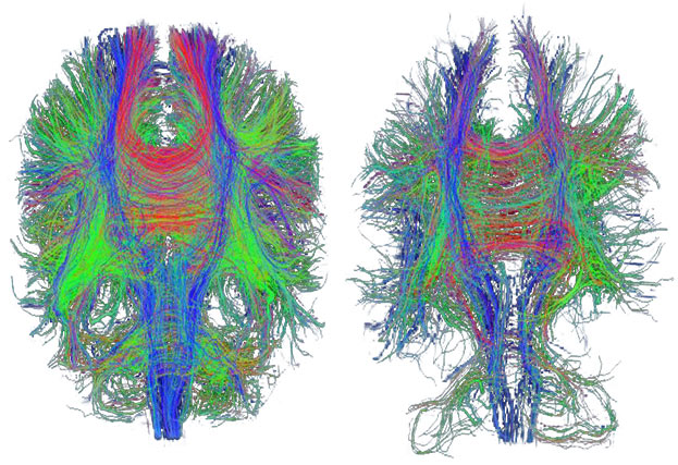 Why the Brain is the Most Interesting Organ