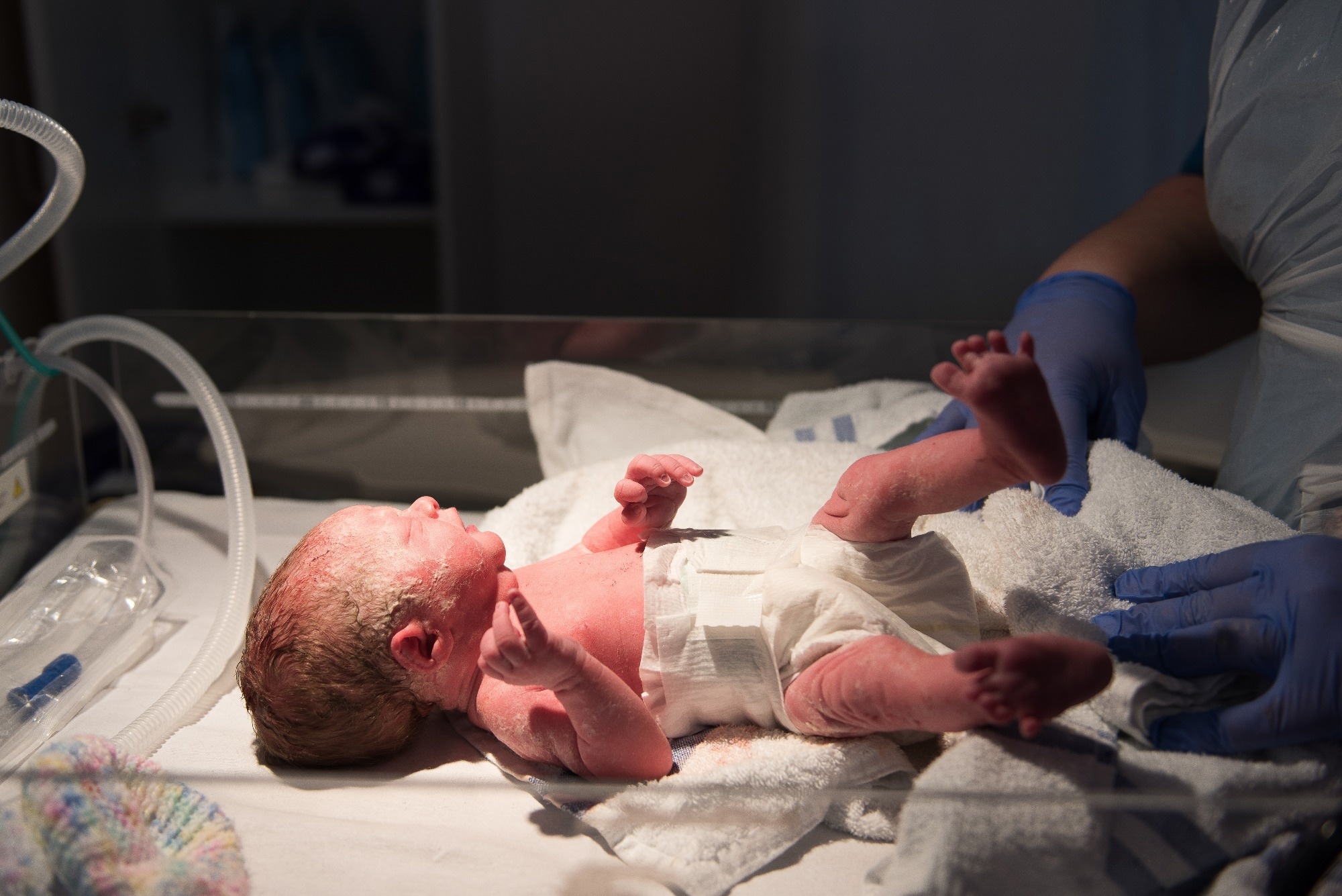 High-dose vitamin D strengthens bones in very low birth weight infants
