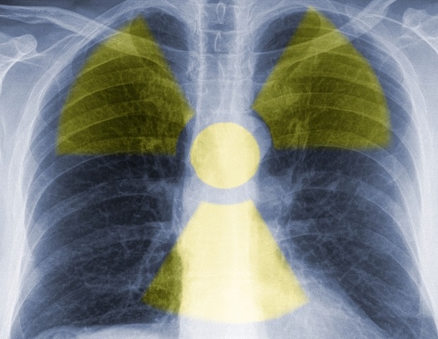 SNMMI launches AI-powered platform to connect patients with radiopharmaceutical trials