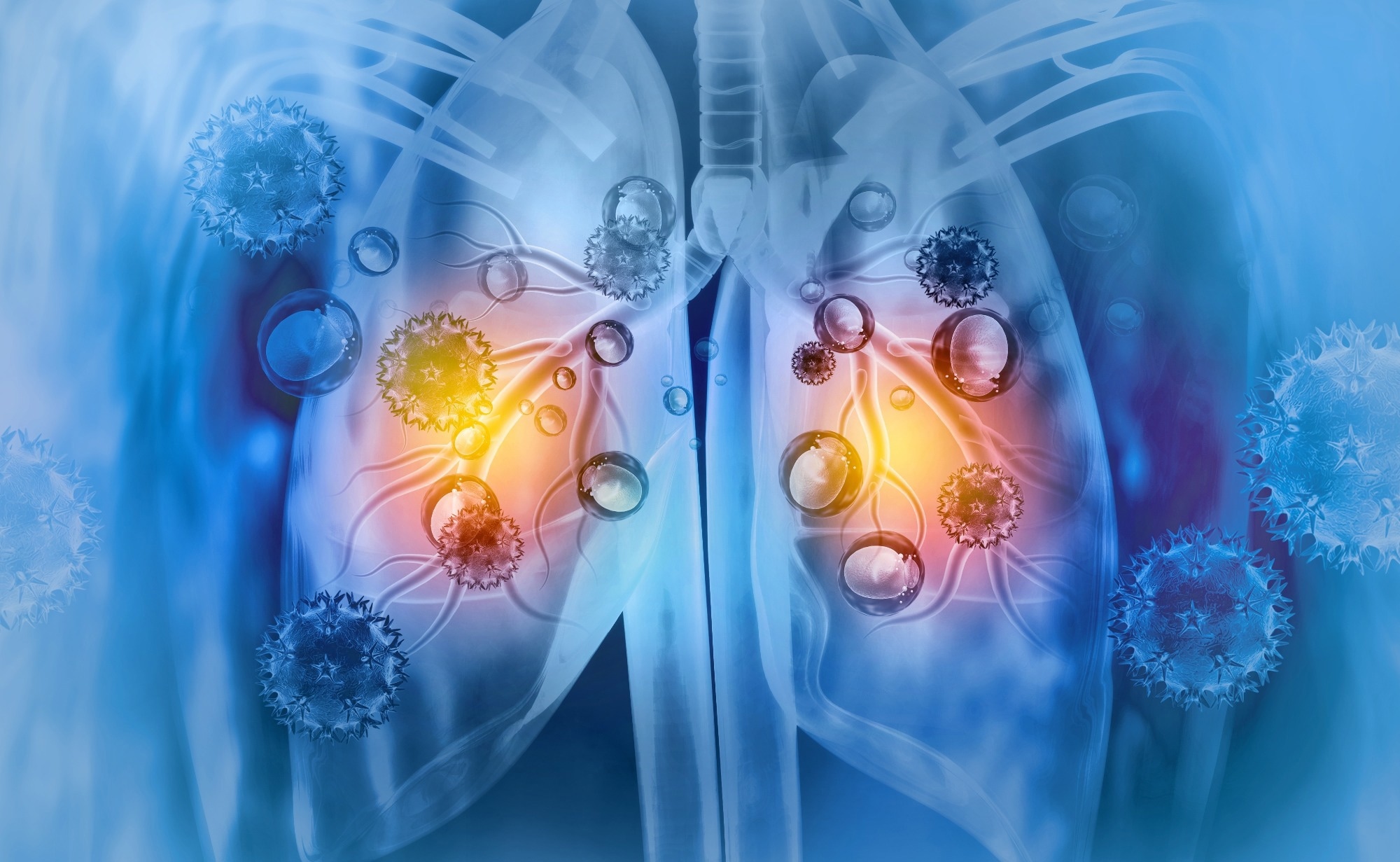 Respiratory viruses awaken dormant breast cancer cells and raise relapse risk