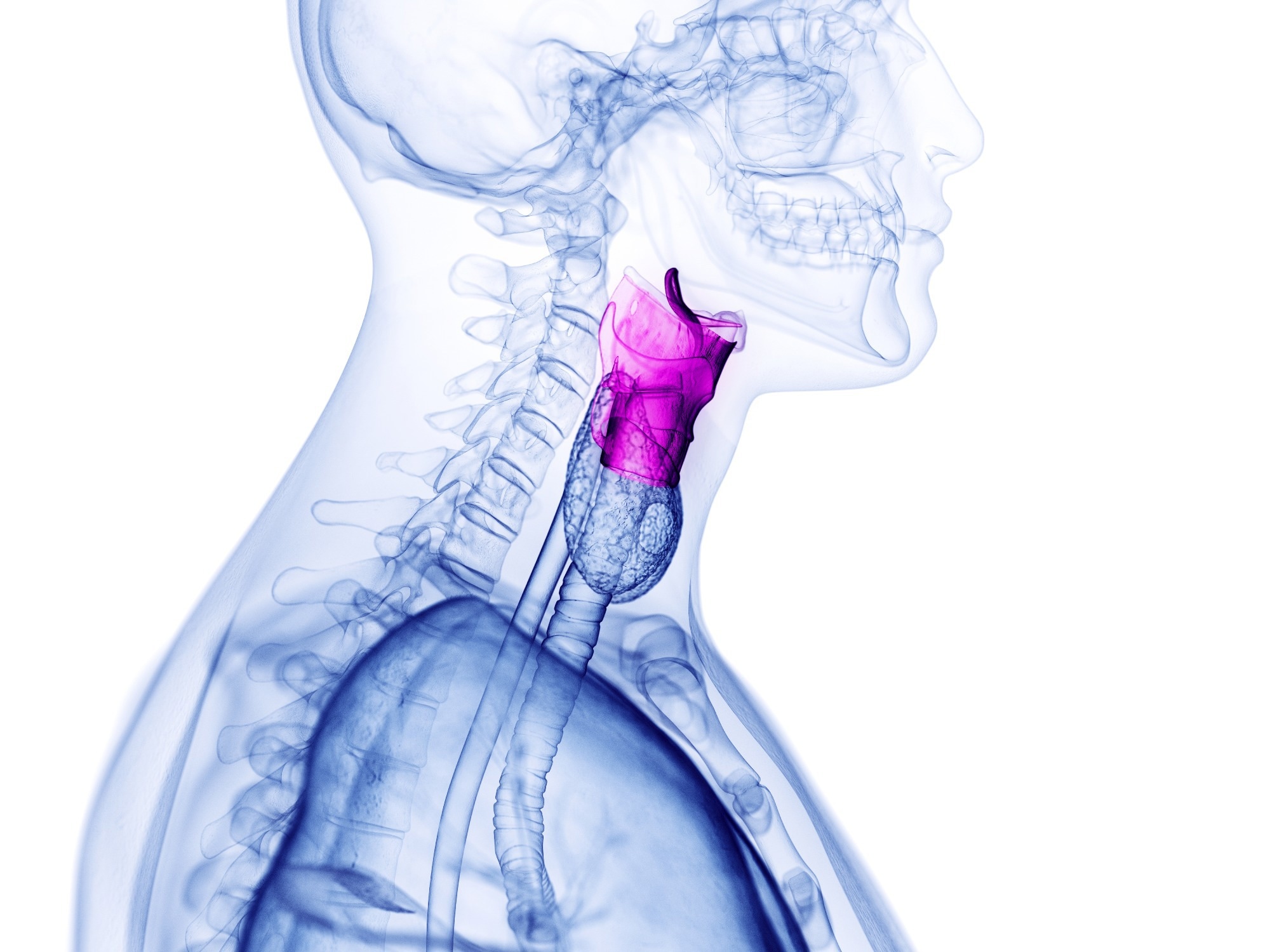 AI voice test could help spot dangerous throat lesions before symptoms appear