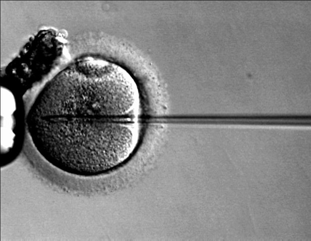 Improving gene therapy safety with human kidney organoids