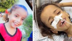 Gaza mother blames famine for halving daughter’s weight