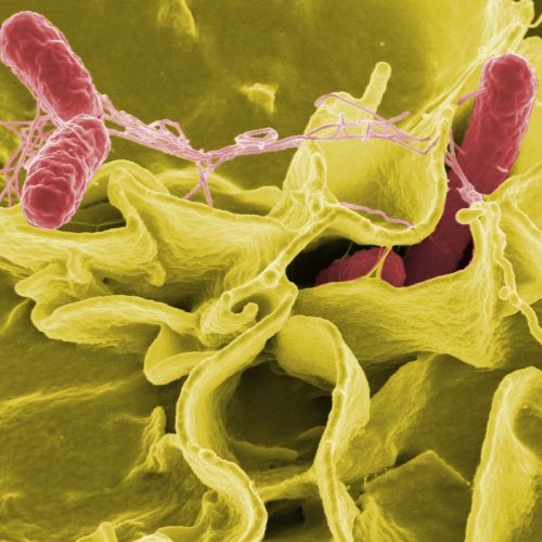 CDC slashed food safety surveillance, now tracks only 2 of 8 top infections