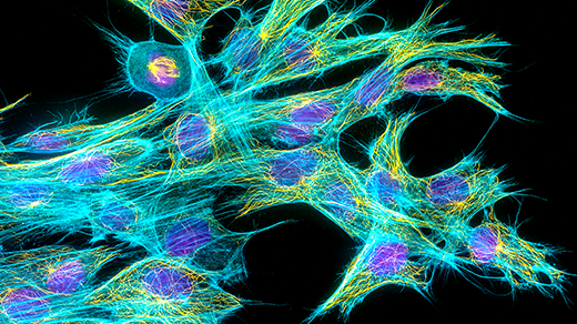 Tiny Tubes Reveal Clues to the Evolution of Complex Life