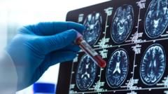 Alzheimer’s blood test could ‘revolutionise’ diagnosis