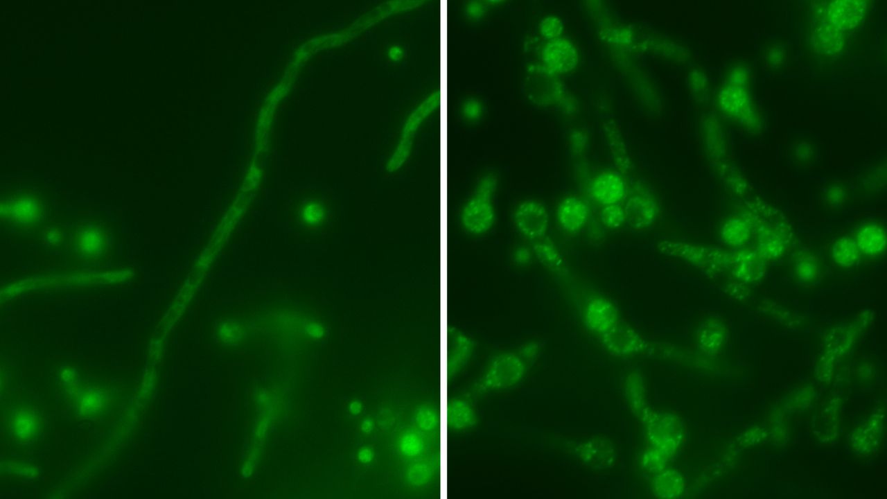 ‘Russian nesting doll’ virus hides inside a deadly fungus, making it even more dangerous to people