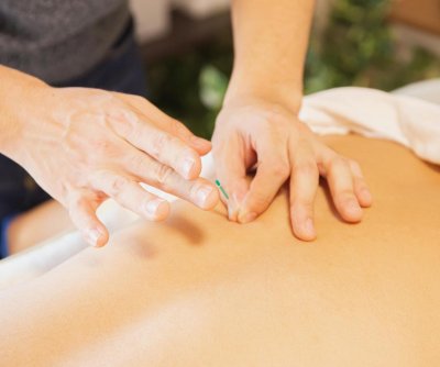 Acupuncture deemed effective for chronic lower back pain in seniors