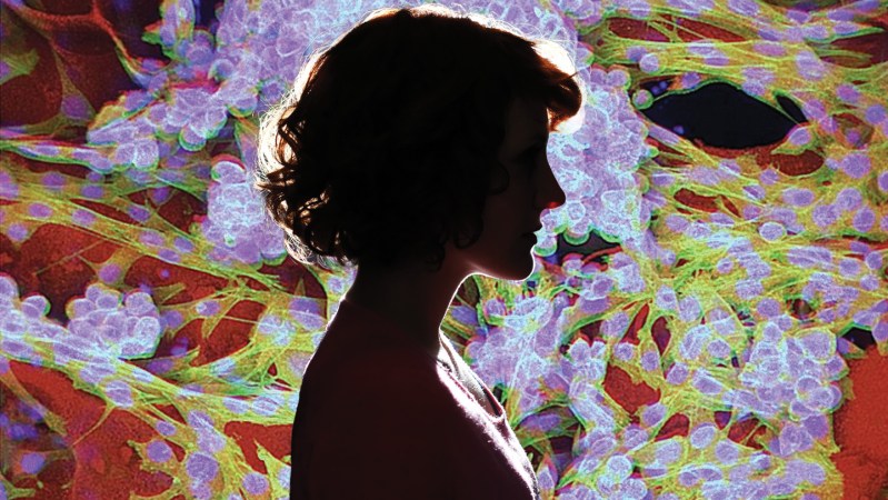 Why are so many young people getting cancer?