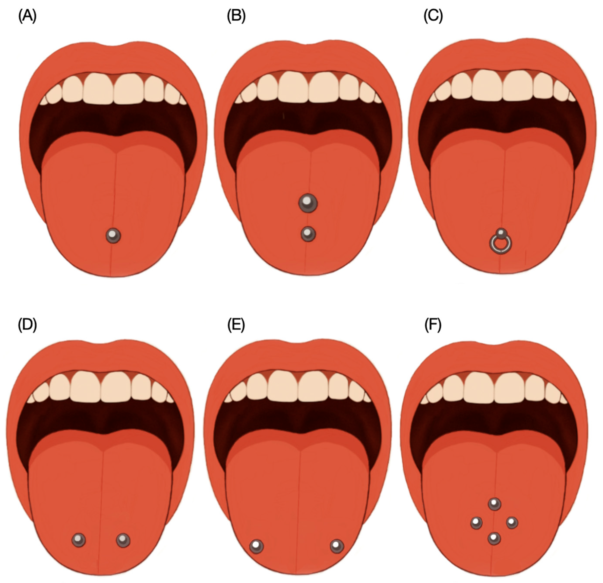 Do tongue piercings harm your oral health? Evidence points to yes