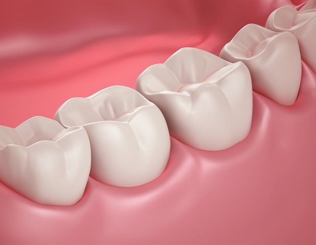Patented antibacterial polymer technology prevents secondary cavities