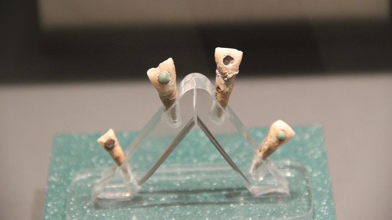 7-year-old Maya child had green jade ‘tooth gem,’ new study finds