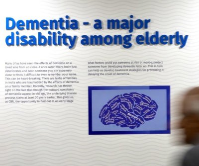 U.K. gene therapy trial effectively treats Huntington’s disease