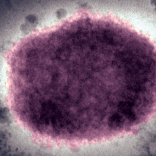 In 2022, the world axed a disease name seen as racist. US just switched back.
