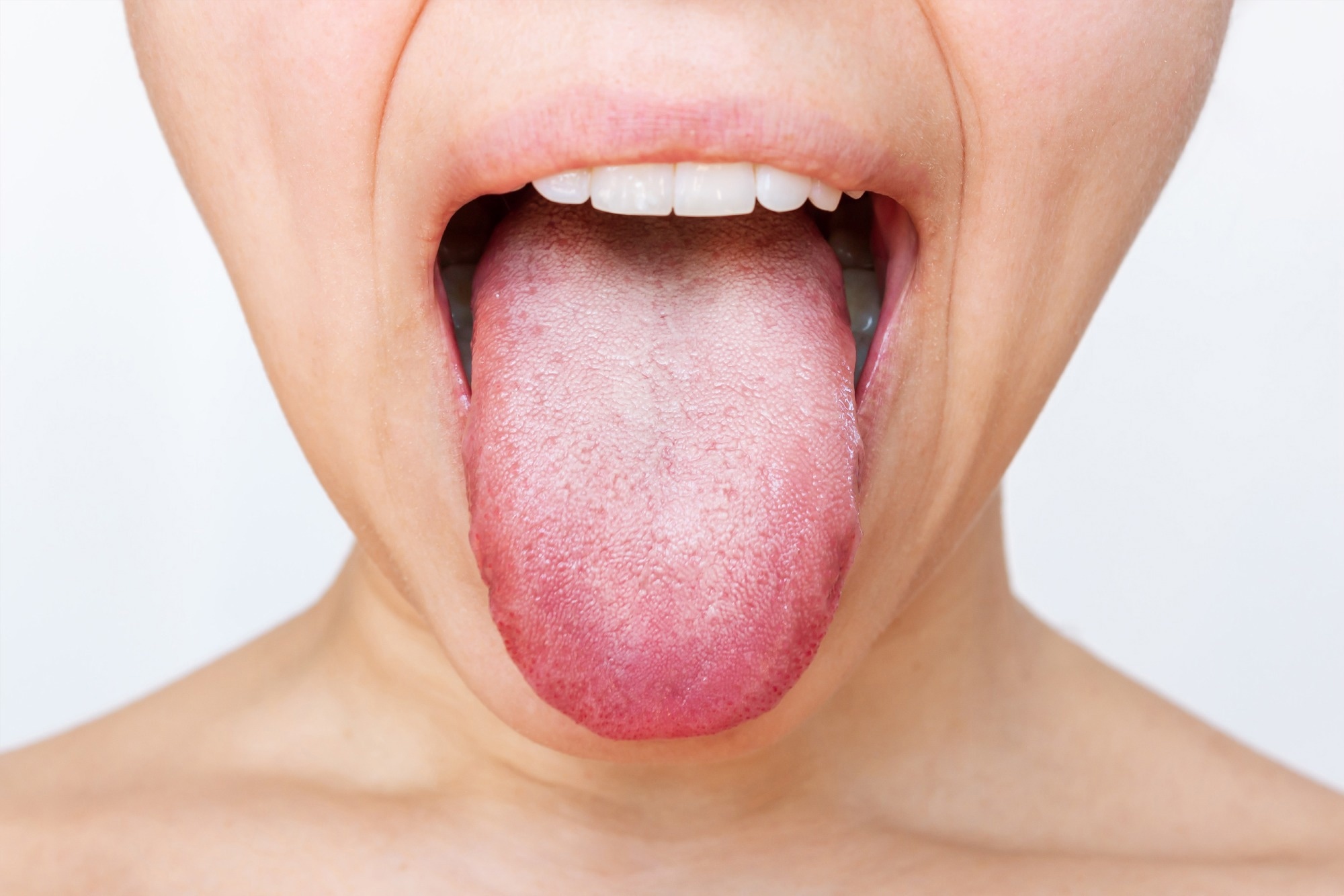 Ozone exposure weakens lung function and reshapes the oral microbiome