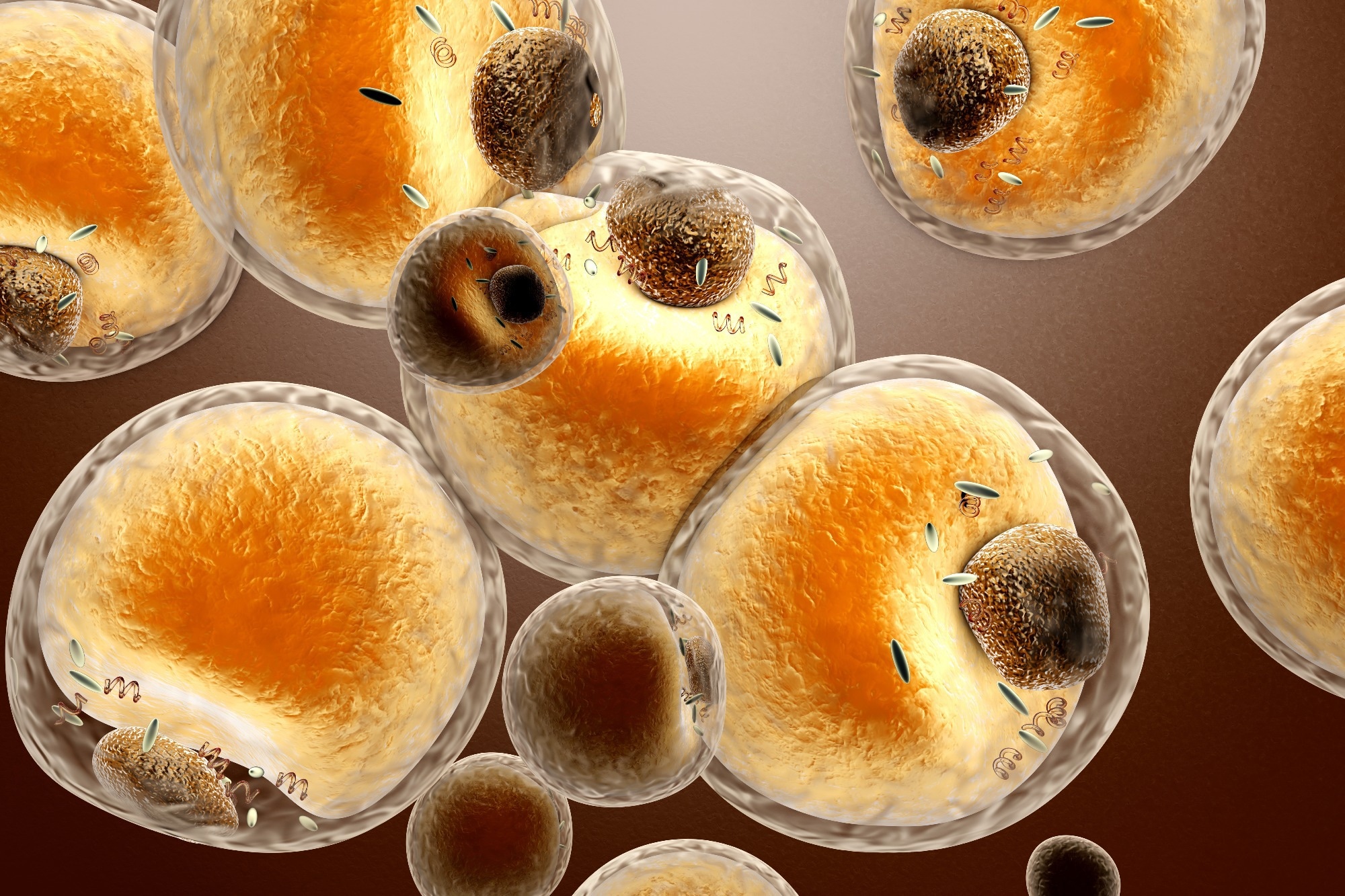 Obesity-linked fat vesicles accelerate amyloid aggregation in Alzheimer’s disease