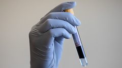 Cancer Blood Test Concerns