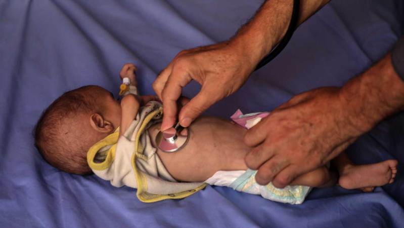 An estimated 54,600 young children are malnourished in Gaza