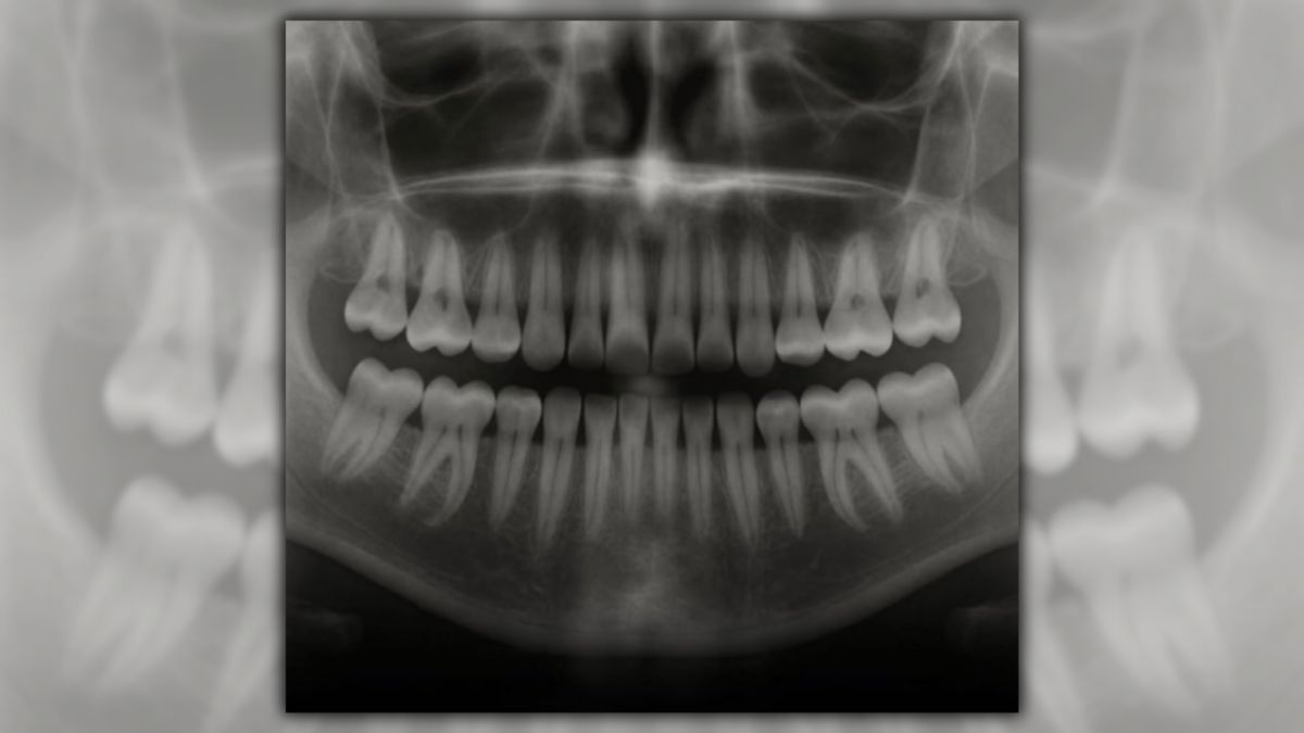 Japanese researchers developed drug that could help people grow new teeth?
