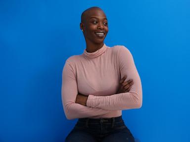 With confidence and support, more women are redefining baldness as beautiful
