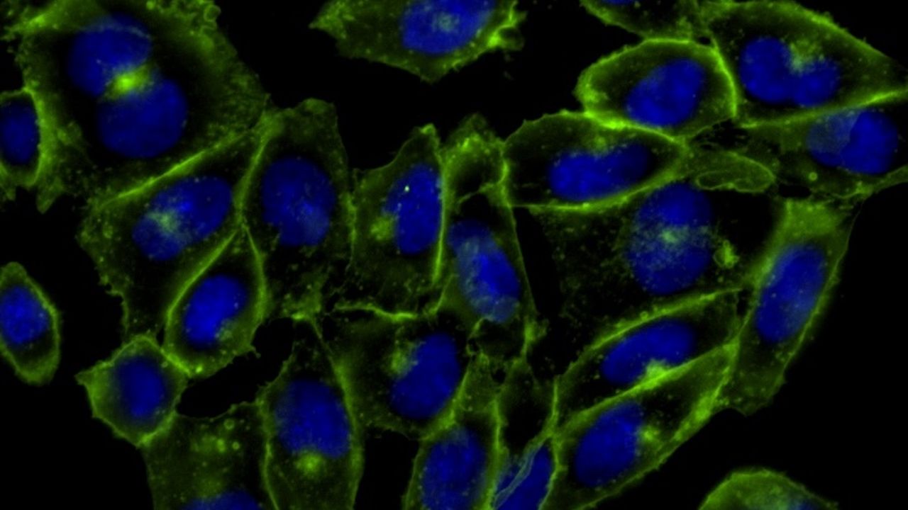 Science history: Scientists use ‘click chemistry’ to watch molecules in living organisms — Oct. 23, 2007