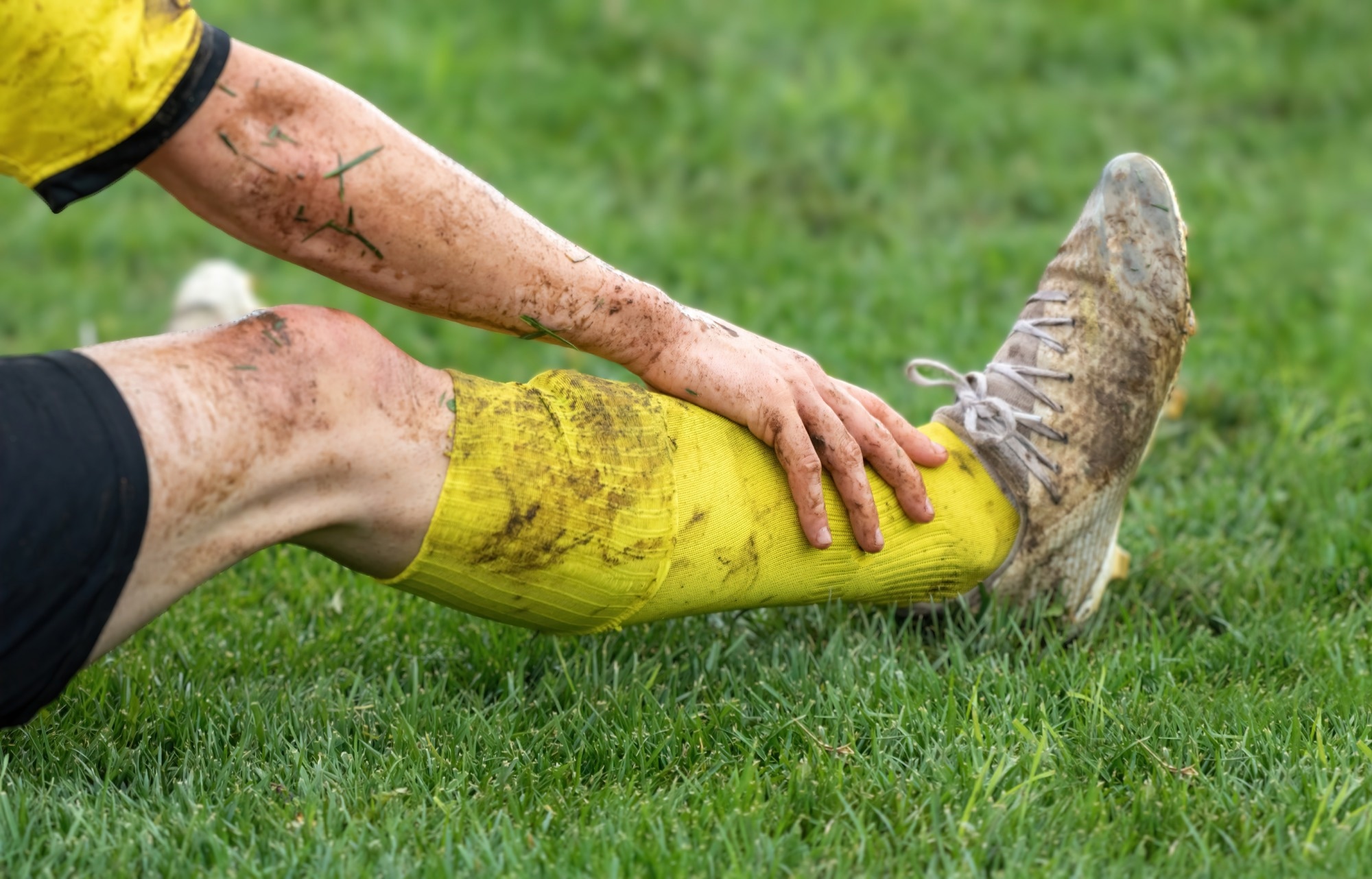 Football injuries, not injections, explain why retired players face higher osteoarthritis risk
