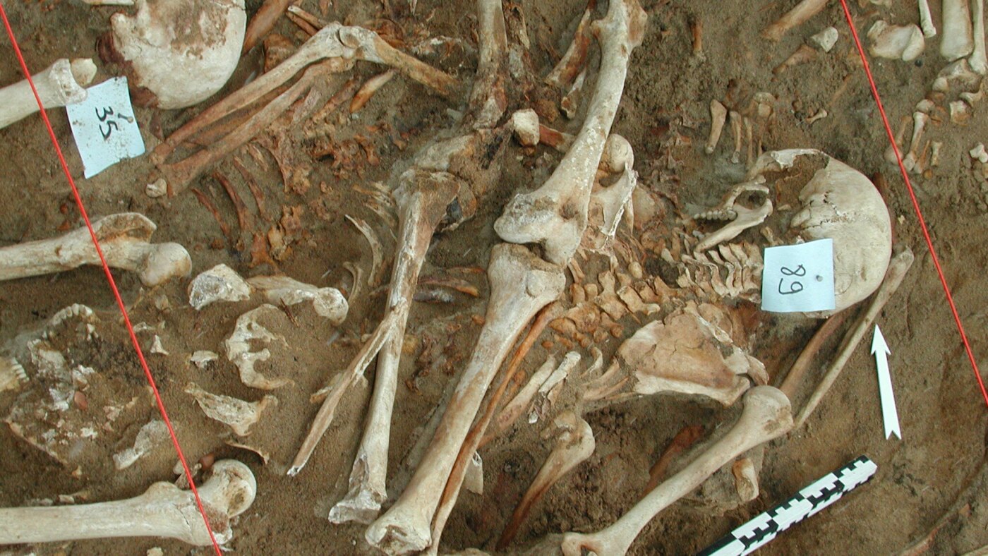 What killed Napoleon’s army? Scientists find clues in DNA from fallen soldiers’ teeth