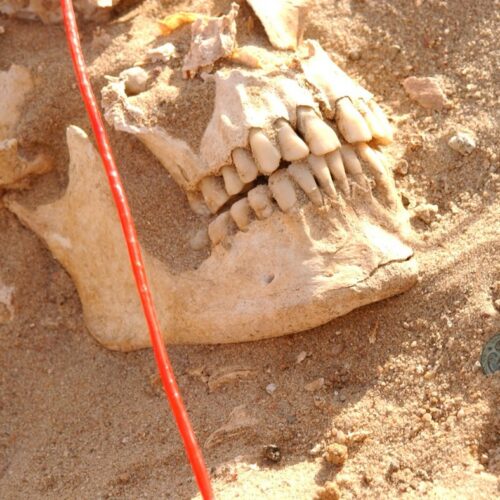 DNA analysis reveals likely pathogens that killed Napoleon’s army