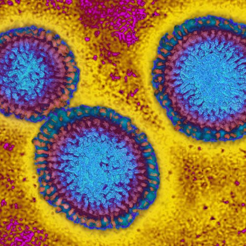 This flu season looks grim as H3N2 emerges with mutations