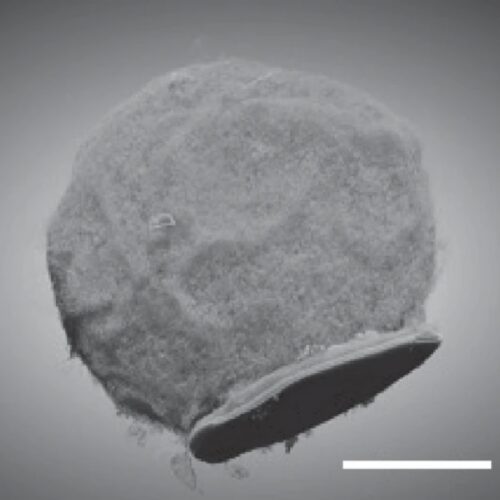 Tiny chips hitch a ride on immune cells to sites of inflammation