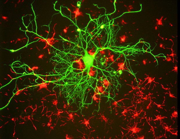 Polymer physics offers fresh perspectives on neurodegenerative diseases