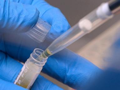 NIH funding cuts have affected over 74K people enrolled in experiments, report says