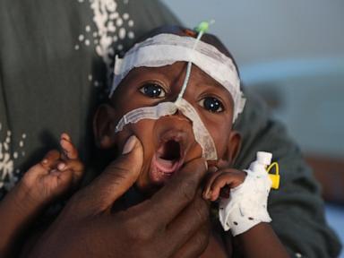 A visit to Somalia’s crumbling hospitals shows the toll of aid cuts and war