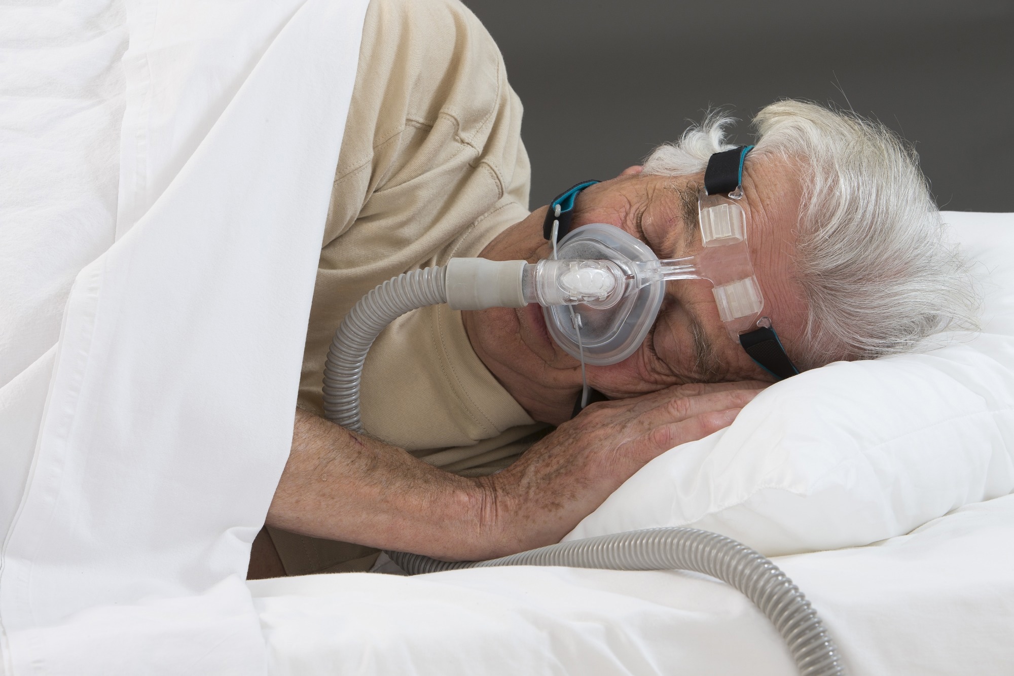 Treating sleep apnea can lower Parkinson’s disease risk