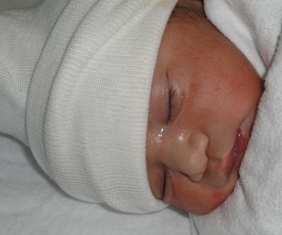 ByHeart recalls all infant formula amid botulism outbreak