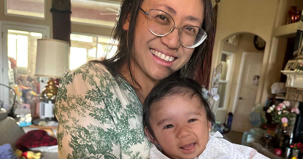 Doctors Deliver Surprise Baby While Removing Mom’s 22-Pound Cyst