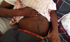 ‘I fled holding my own intestines after I was cut open in bid to steal my unborn baby’