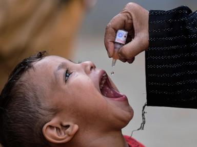 Pakistan’s polio cases fell by half in 2025 despite attacks on vaccination teams