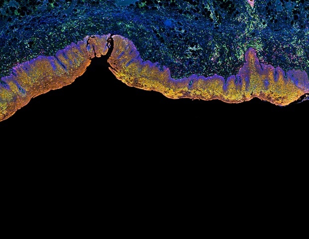 Understanding sevoflurane-induced neurogenesis inhibition and cognitive dysfunction in children