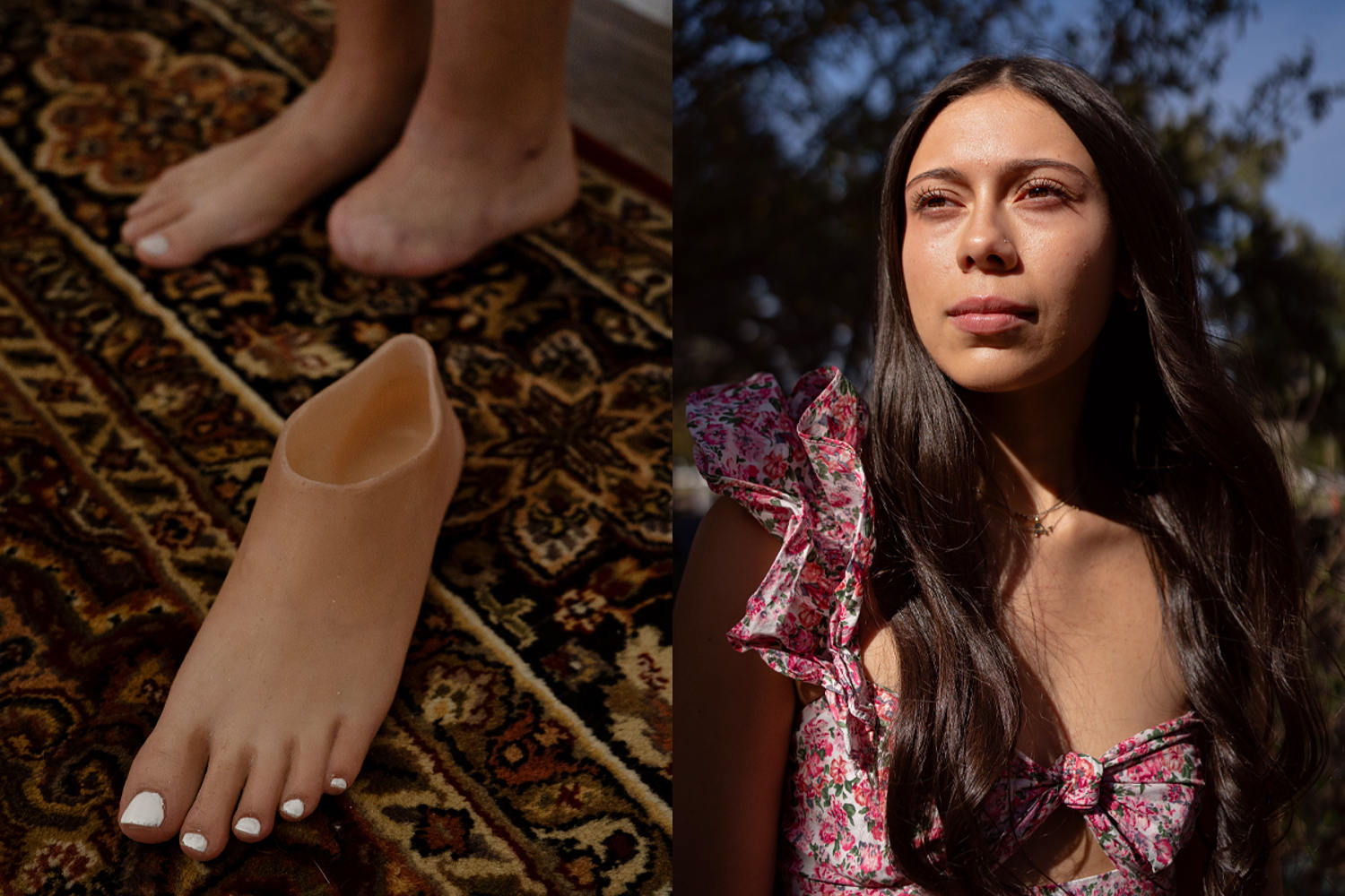 A college student fights an insurance denial to get a prosthetic foot before graduation