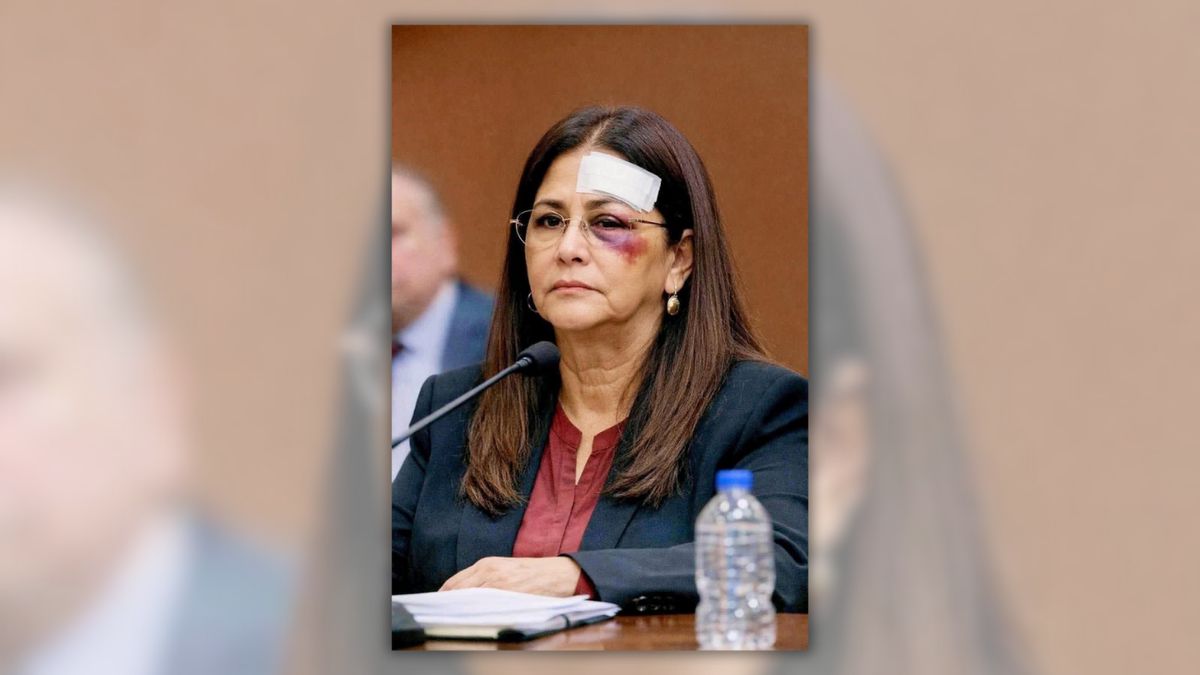 This image doesn’t show Cilia Flores in court with head bandage and black eye. Here’s the proof