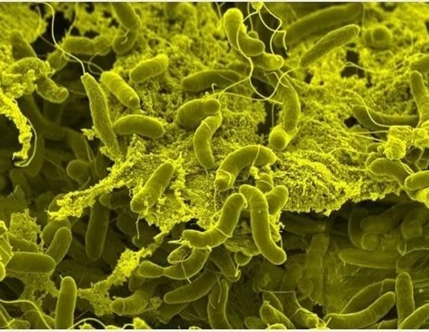 Scientists reveal how cholera bacteria activate toxin genes in the human gut